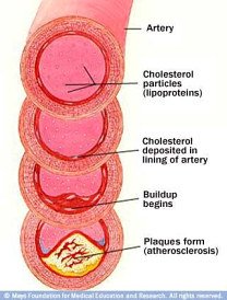 heart health and nutrition